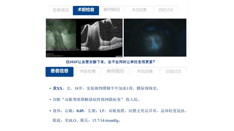 抗VEGF让血管安静下来,会不会同时让牵拉变得更紧?